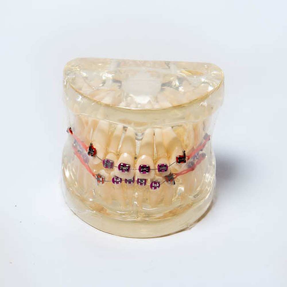 Brackets Roth 022 Metal Prescurved Orc - Imagen 2