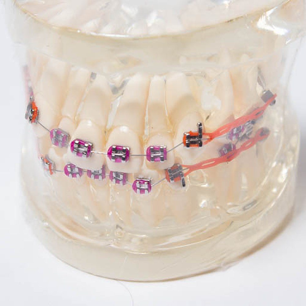 Brackets Roth 022 Metal Prescurved Orc - Imagen 3