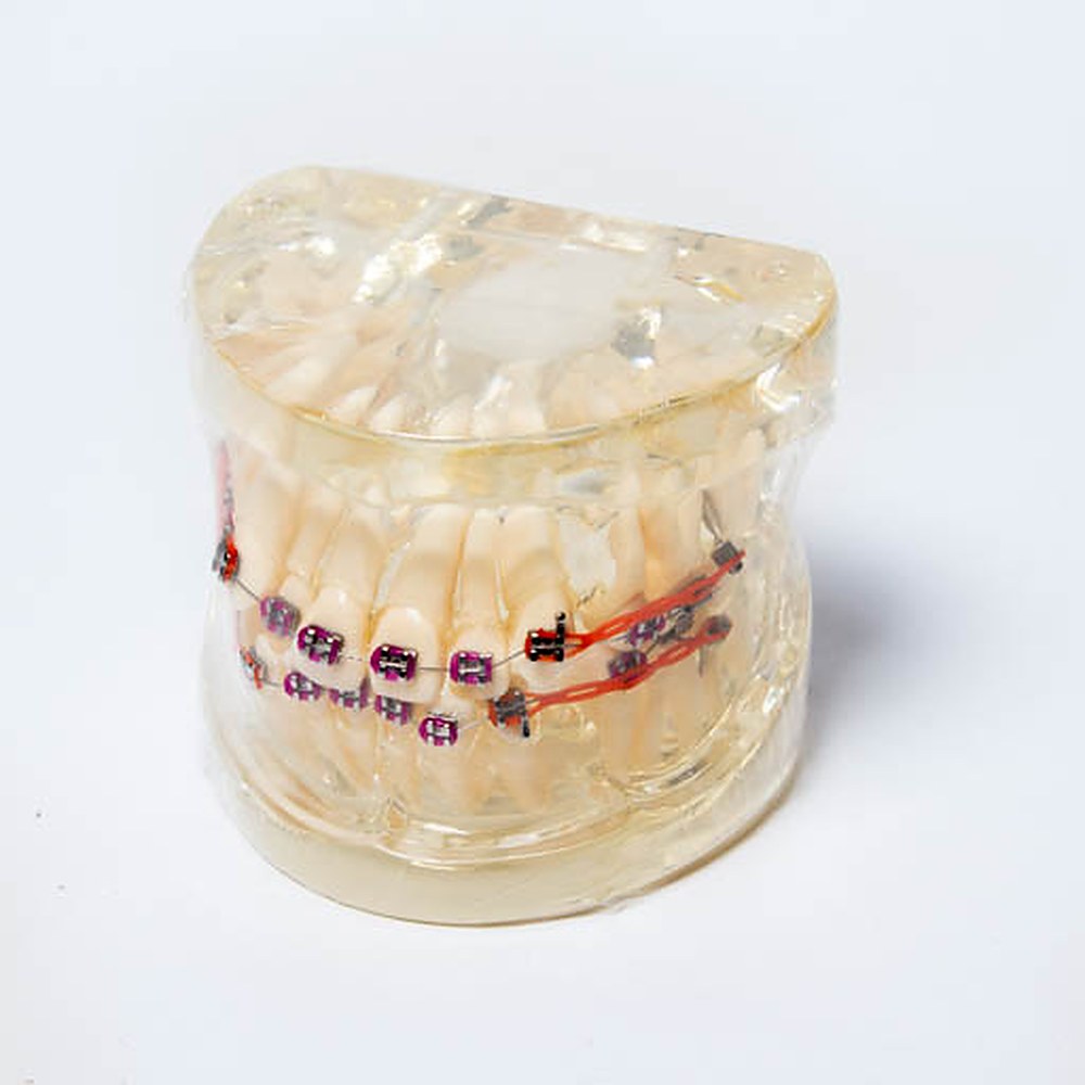Brackets Roth 022 Metal Prescurved Orc